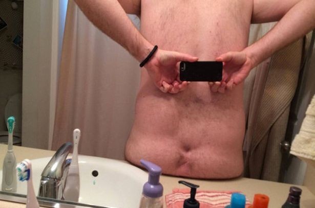 Reddit: Users shared their problems with similar conditions