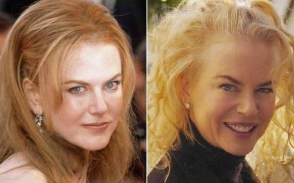 Nicole Kidman