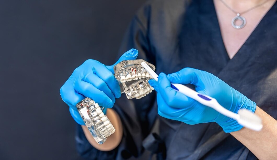 Common All-on-4 Dental Implant Issues and How to Resolve Them