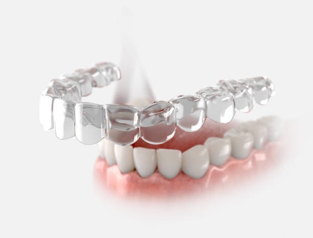 Why You Should Consider Orthodontic Treatment